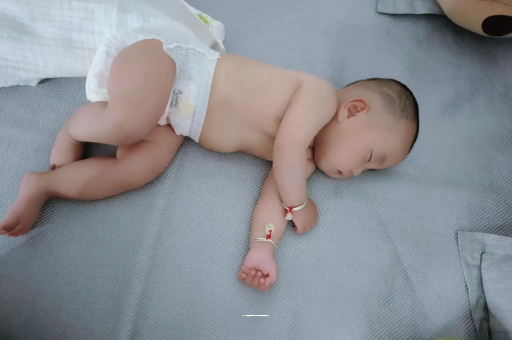 孝感宝宝头上长痱子